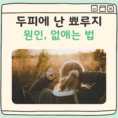 두피에 뾰루지 원인 및 없애는 방법 쉬운 정리 대표 이미지