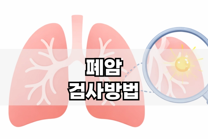폐암 검사방법