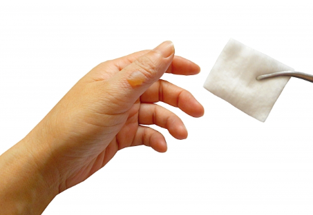 화상'은 어느 정도로 병원에 가야 되나요