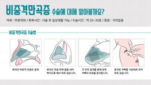 비중격 만곡증