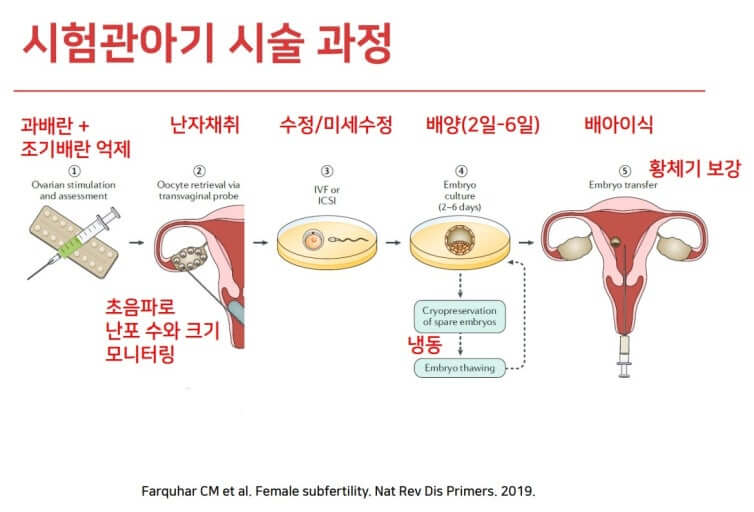 생식 기술의 혁신! 체외 생식세포 생성(IVG) 기술이 가져올 미래