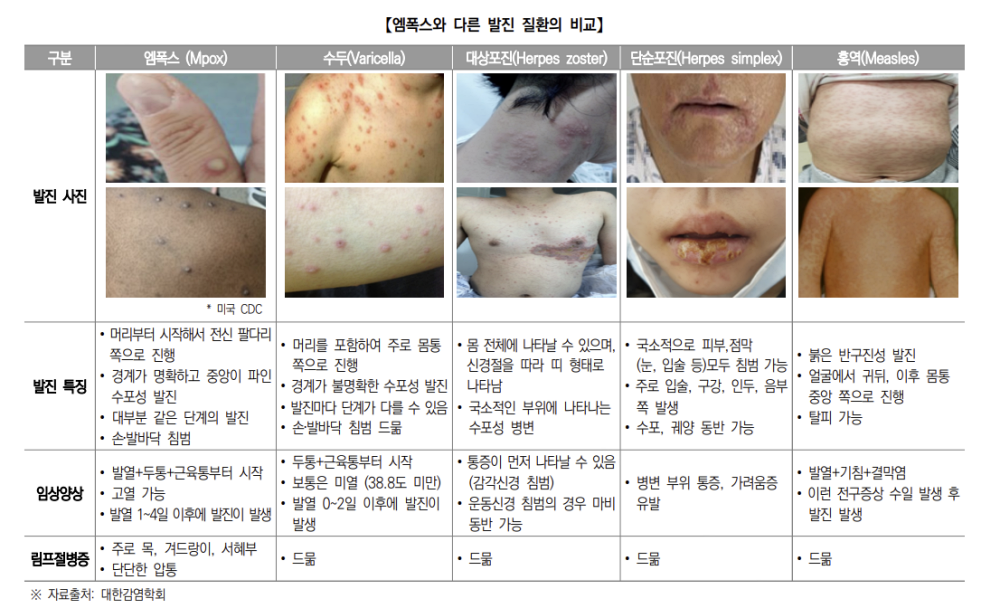 질병관리청 엠폭스 증상