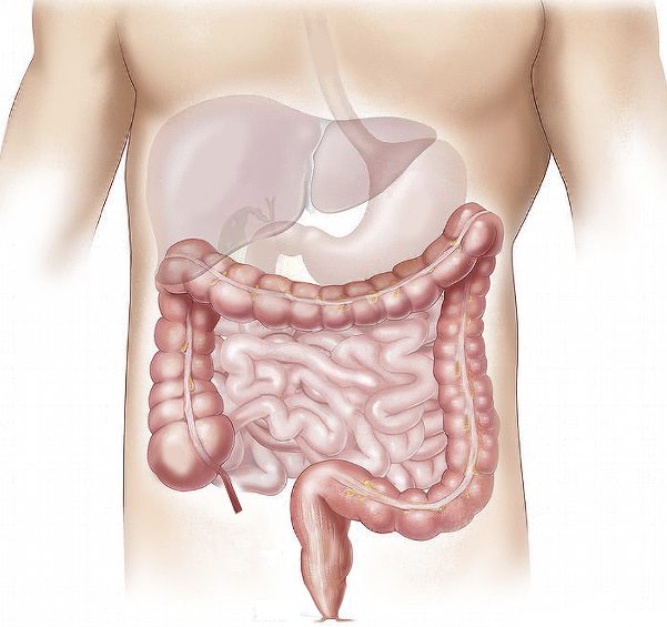 명상과 장건강 - 장내 미생물, 스트레스, 그리고 삶의 질의 변화