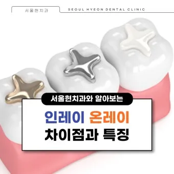 인레이 온레이의 차이와 치료 방법_4