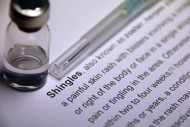 대상포진 예방접종 비용확인 초기증상 치료