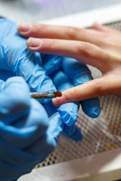 조갑주위염, 손톱염증을 일으키는 거스러미를 아시나요? 나도 모르게 항상 입으로 손을 뜯고 있는 나를 발견하는데요. 절대로 하지 말아야 할 행동입니다. 아무 생각없이 뜯고 있으면 피까지 나올 때가 있습니다. 왜 생기고 어떻게 예방을 해야 하는 걸까요?