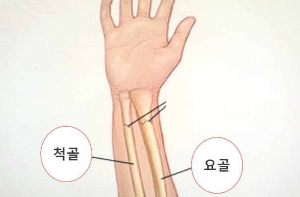 척골 골절의 진단과 치료