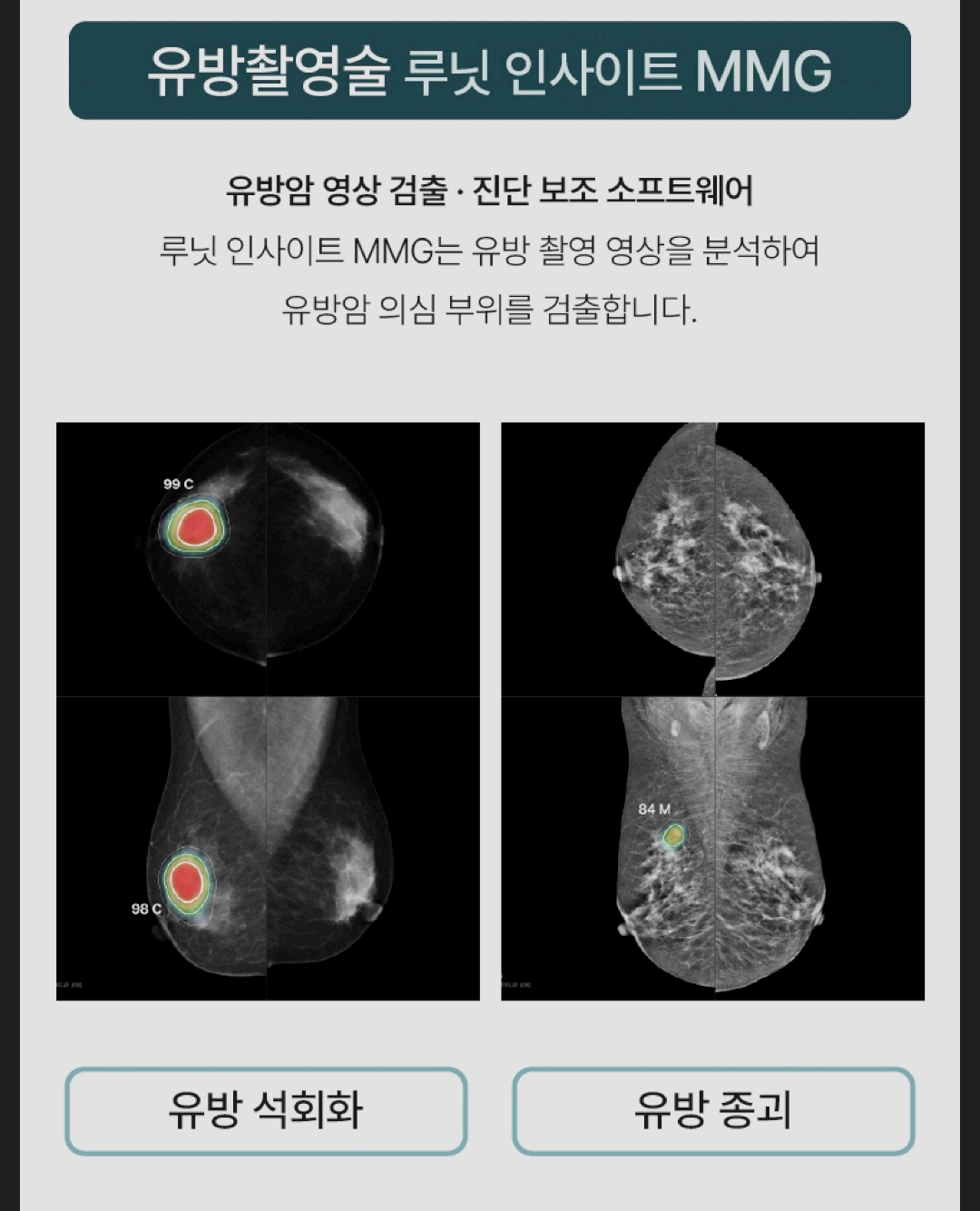 ai건강검진