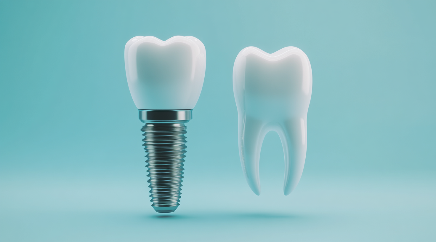 임플란트 실패의 주요 원인