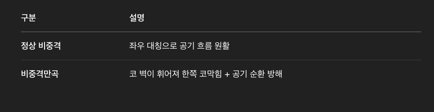 비중격만곡증이란