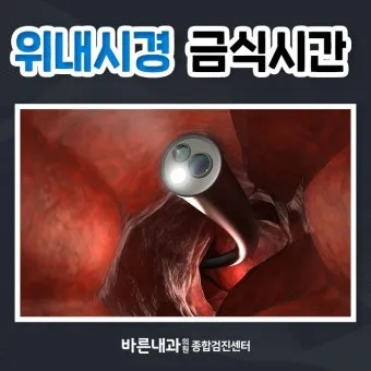 위내시경 금식시간 전날 음식 꼭 알아야 할 주의사항_24