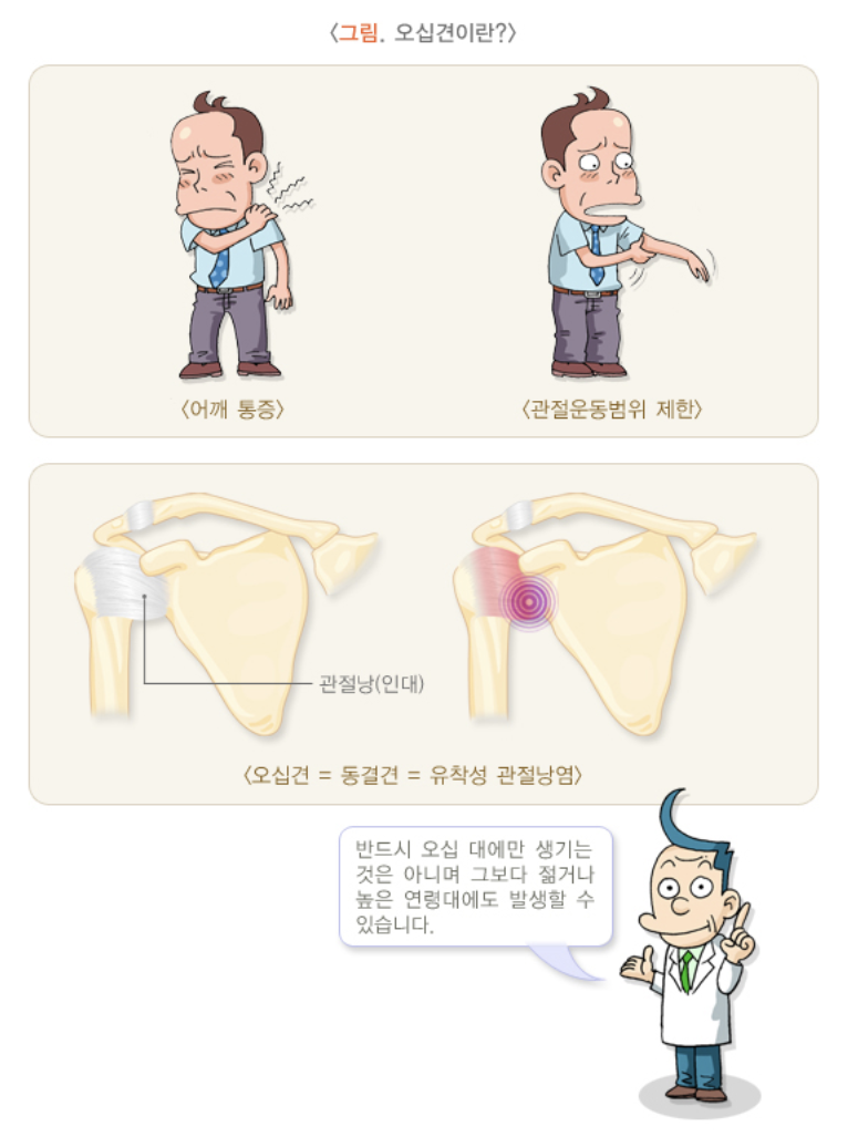 오십견