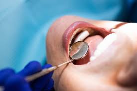 치과 치료비 건강보험 적용 범위 체크하기