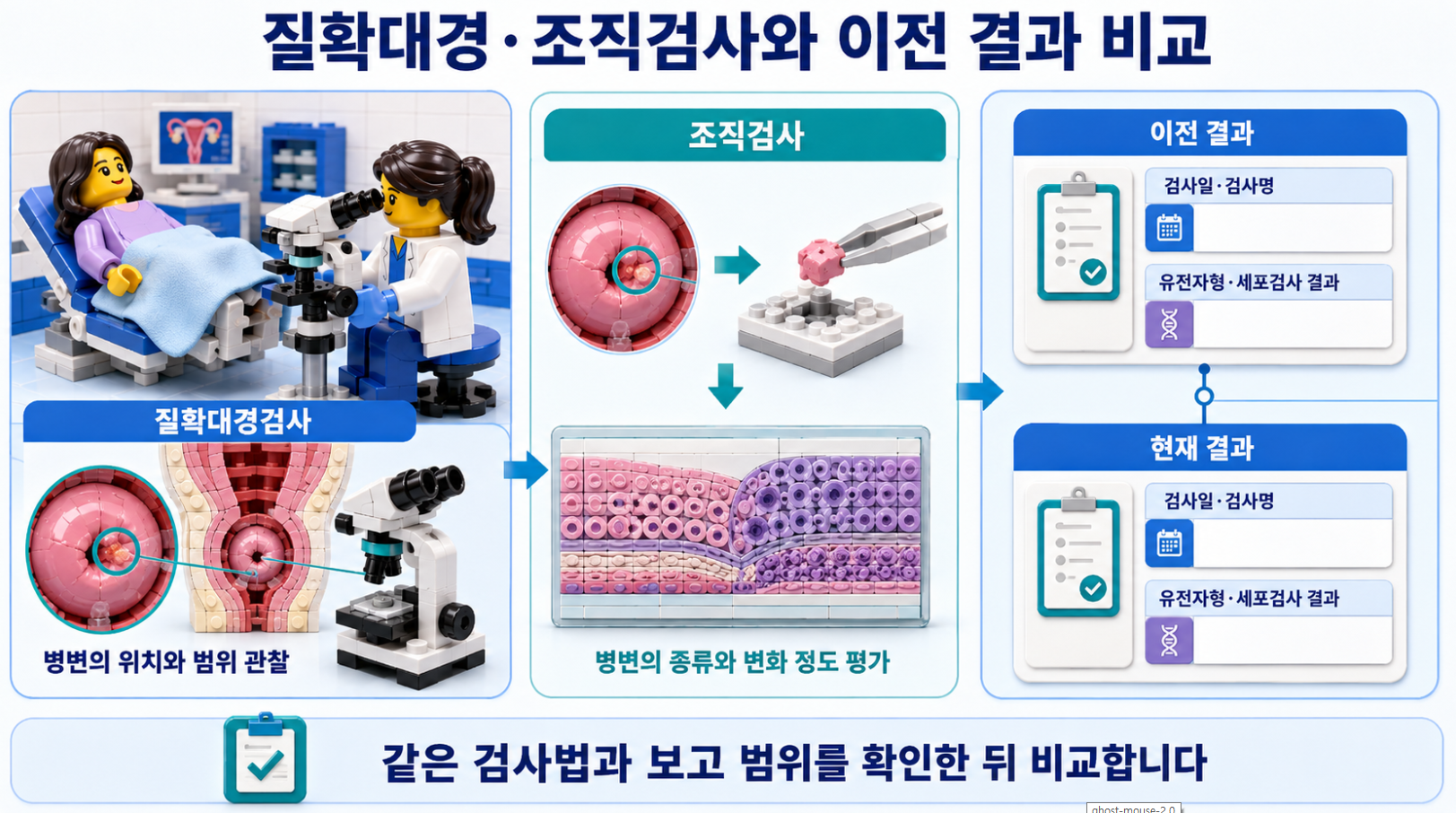 질확대경검사로 병변 위치와 범위를 관찰하고 조직검사 및 이전 결과를 비교하는 과정을 설명한 인포그래픽