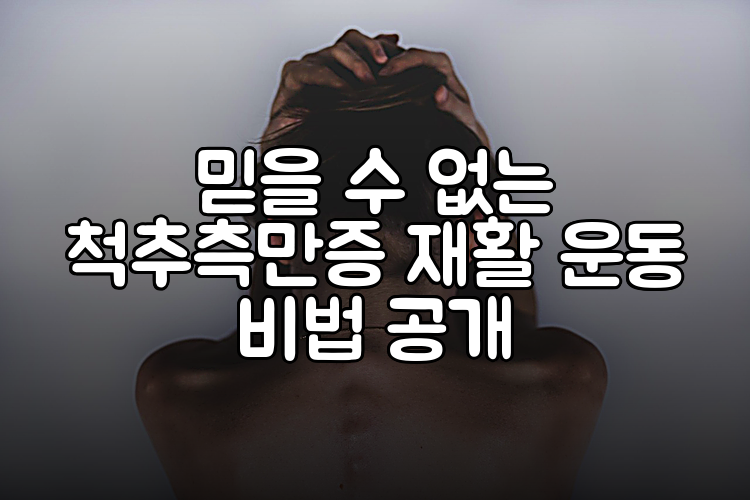 믿을 수 없는 척추측만증 재활 운동 비법 공개