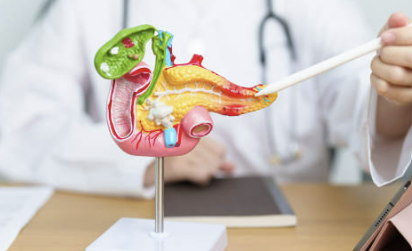 췌장암 초기증상 검사방법 생존율 알아보자!