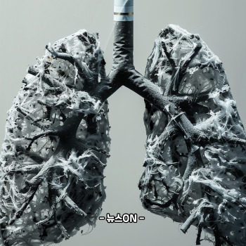 이문수 사망 폐암