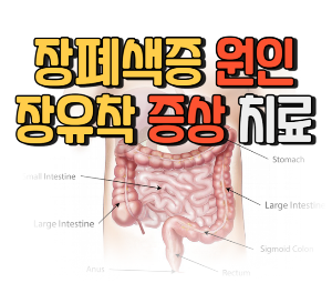 장폐색증