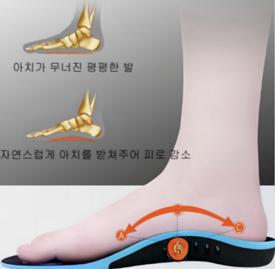 아치 서포트 깔창 이미지