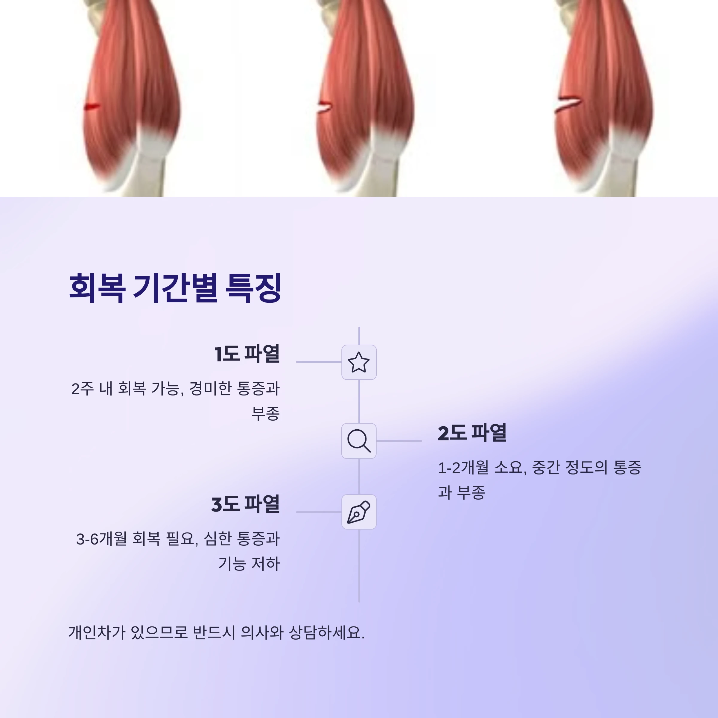 종아리-힘줄파열-회복기간