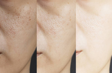 글루타치온 효능&amp;#44; 부작용&amp;#44; 많이든 음식 총정리 (2025ver)