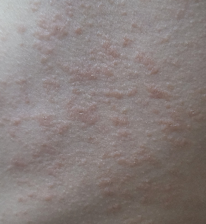 중학생 장미색 비강진