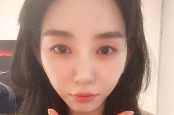 권민아 친언니 횡령