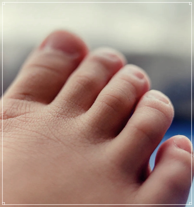 발가락 실금: 원인, 증상, 그리고 치료법
