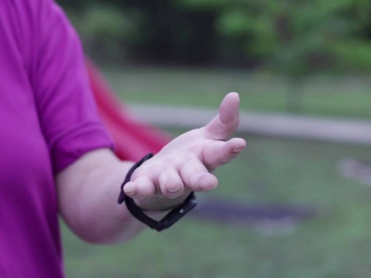 방아쇠 수지 증후군 증상