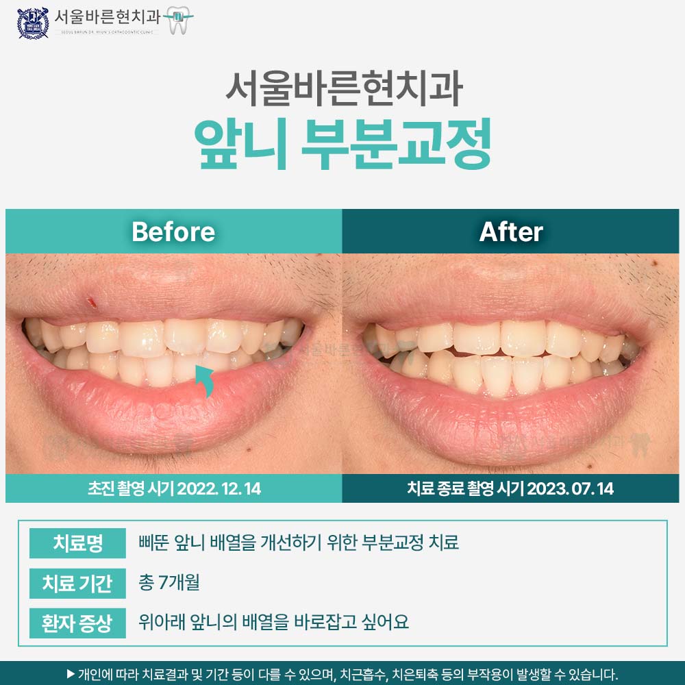 해운대교정치과