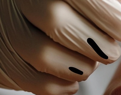 얼굴이 가려운 이유