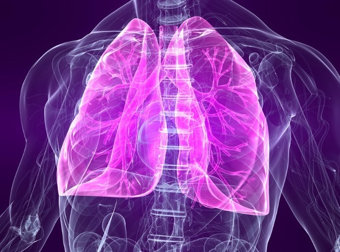 x-ray와 같은 사진에 폐를 강조시킨 사진