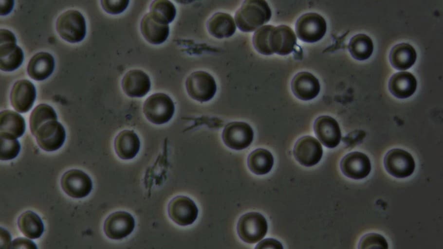 현대인의 체내 독소 해독 – 간 건강을 지키는 실질적인 방법