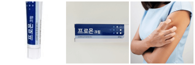 프로몬크림, 가려움증 사진