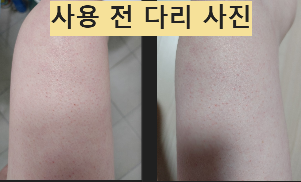 비요코 항아리 발효감 클렌저 사용전