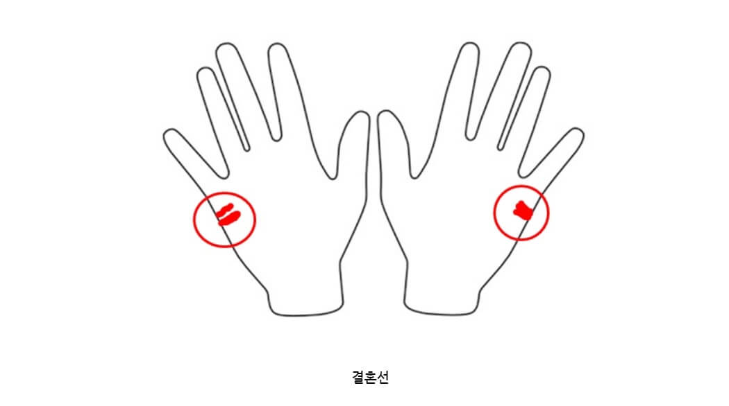 남자 손금 보는 법-결혼선