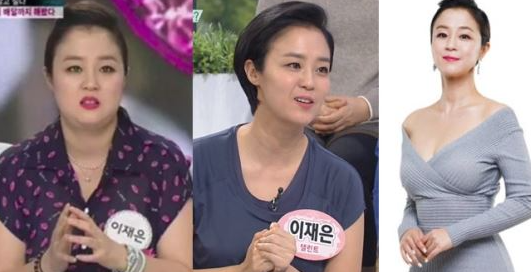 이재은 비만
