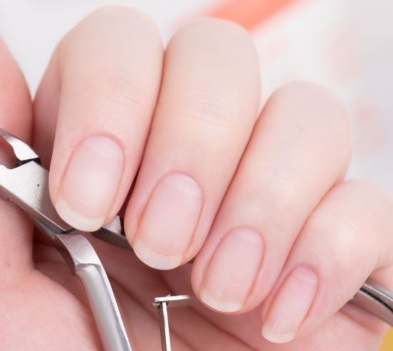 손톱 세로줄 치료