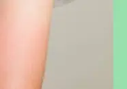 땀띠 원인과 증상 &amp; 치료