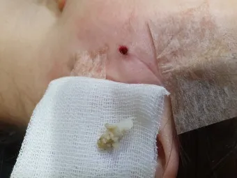 남자 얼굴 피지 제거 화장품 꿀템_27