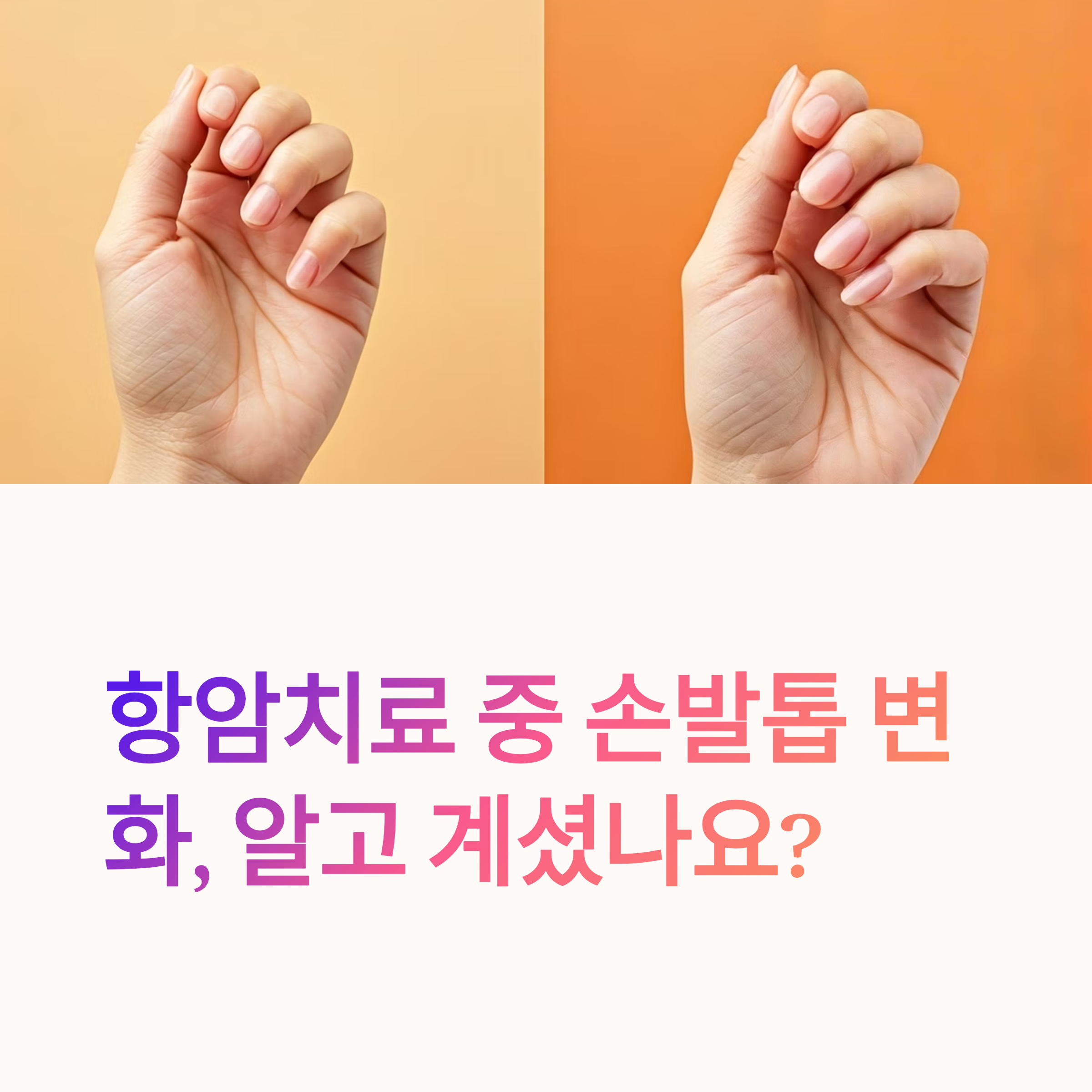 항암치료 손발톱 변화 대표이미지