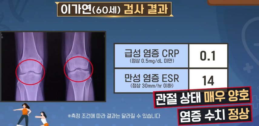 콘드로이친 효능