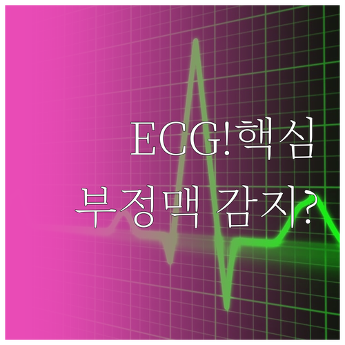 스마트워치 심전도 ECG 부정맥 감지..