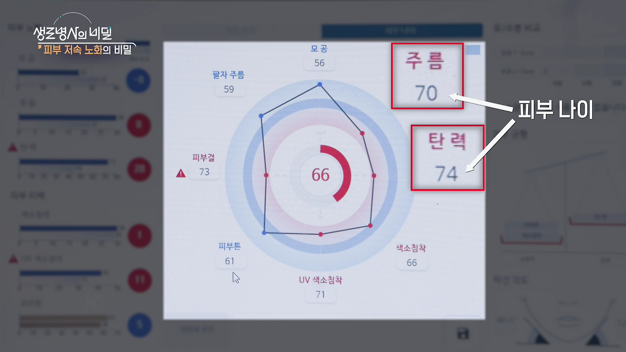 생로병사의 비밀 피부 저속노화의 비밀