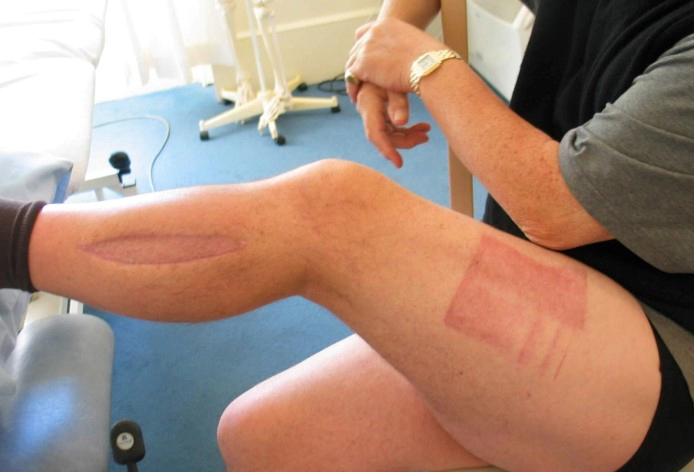 김사부3 구획증후군