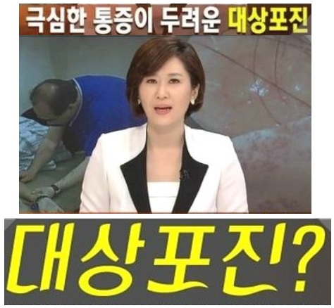 대상포진-관련뉴스