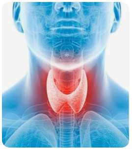 남성 갑상선 질환