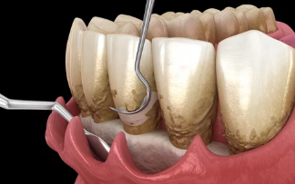 스케일링 이미지/출처:어도비스톡