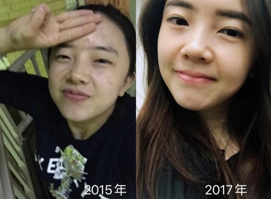 성형논란에 꿋꿋 '대인배' 전지희