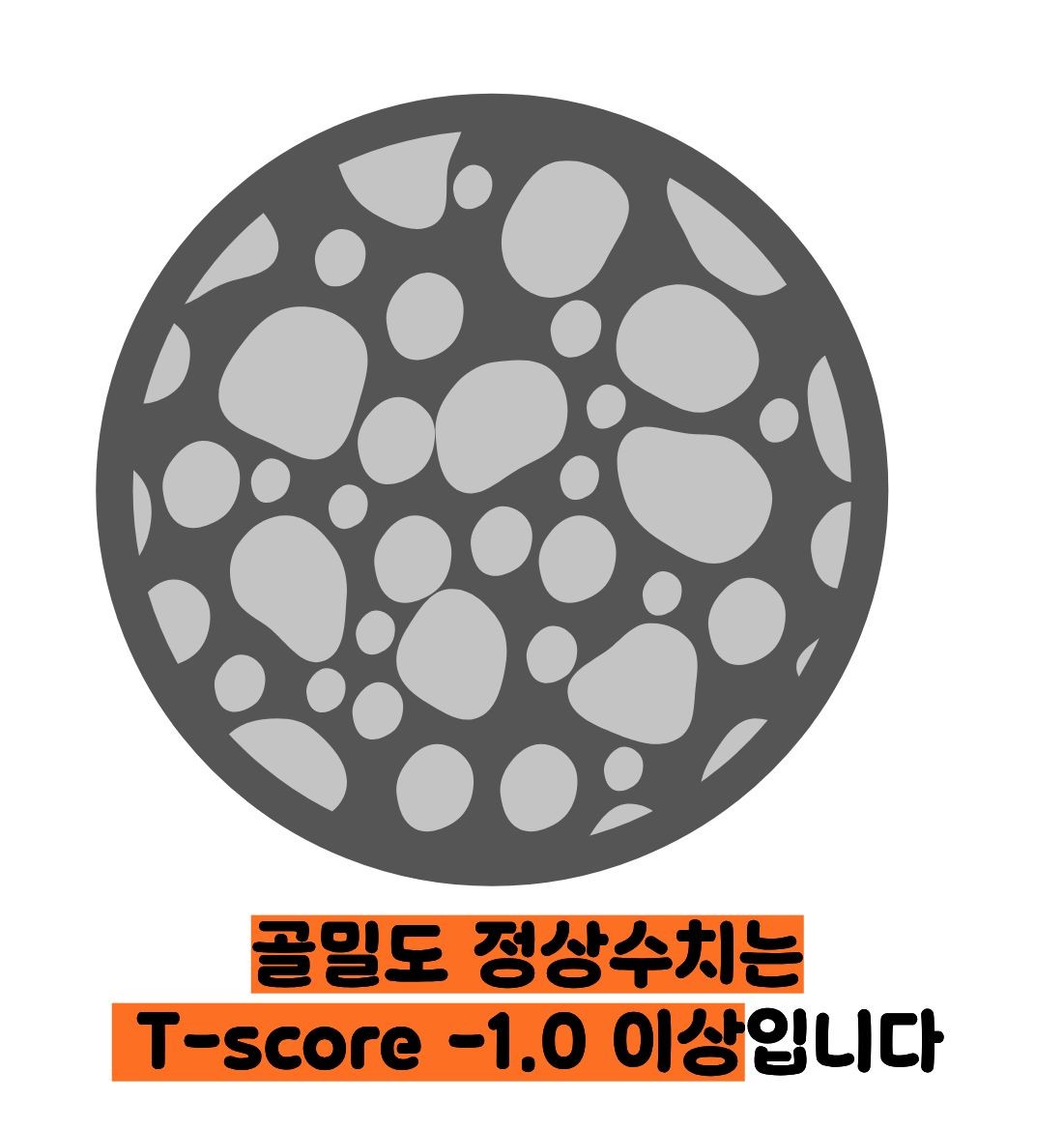 골밀도 정상수치